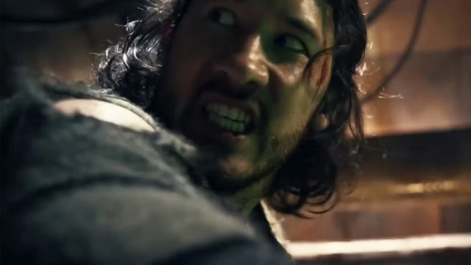 Марк Фишбах в фильме Железное легкое